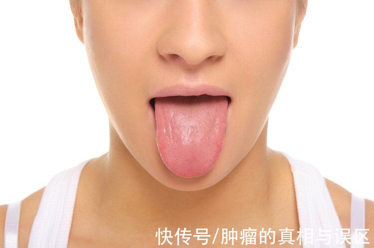 朱翠玲|舌头是“心之苗”，若出现4个不适，或是身体在“求救”，别大意