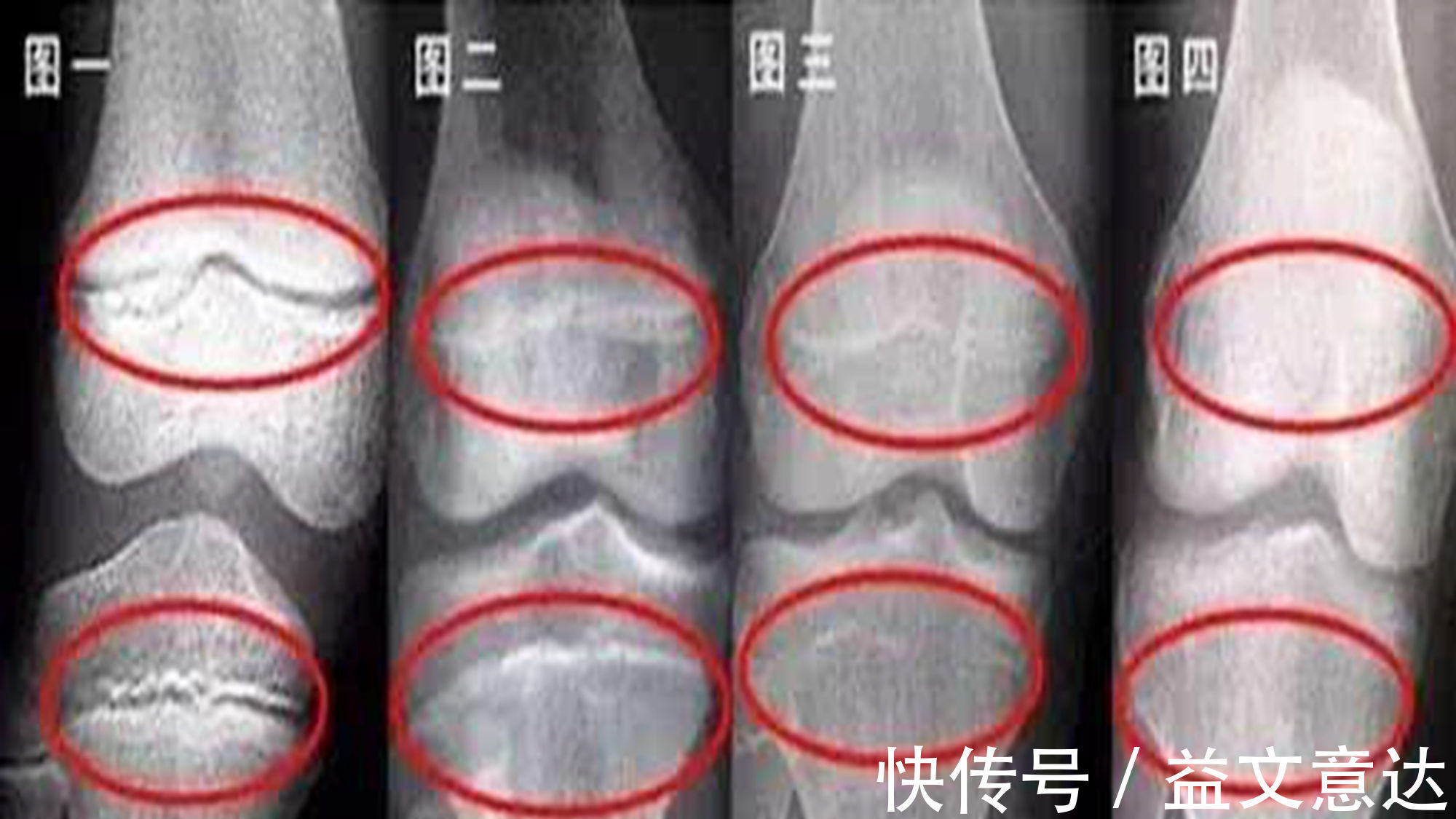 身高|女孩初潮时间决定了身高发育，科学家：早于这个时间，往往会矮小