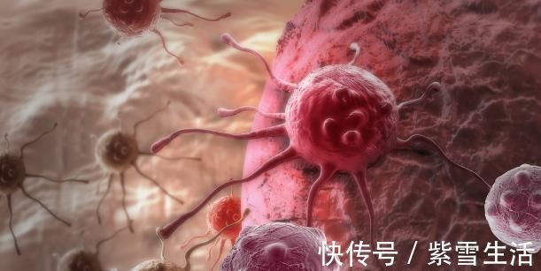 应激激素|工程院院士：“抗癌”其实很简单，不花一分钱，让你身心都健康！