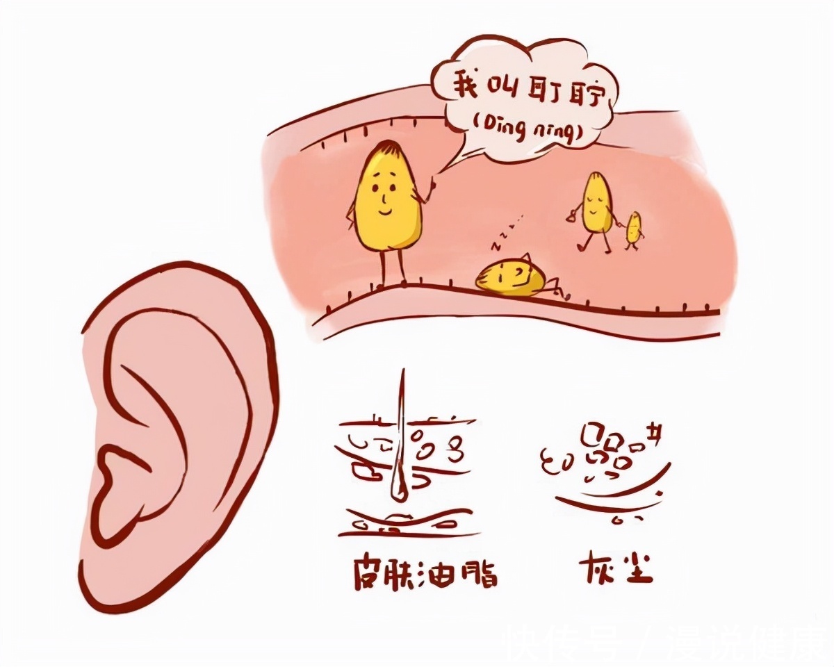 好处|1个月2-3次即可？频繁掏耳朵，医生眼中的好处只有这一个！