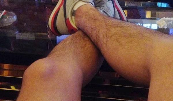 毛发|为什么有的男性腿毛旺盛,有的比女性还“光滑”告诉你准确答案