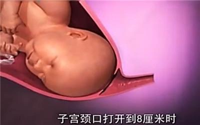胎头那么大，到底是怎样从那么小的口出来顺产分娩全过程-附图
