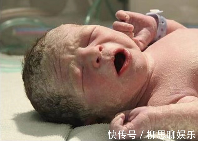 宝宝|95后宝妈生下“雪人宝宝”,全家吓得没人敢抱,医生却说恭喜了