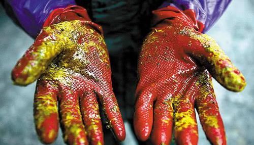  尿毒症的“元凶”已经被找到，“三高”饮食在列，第一个经常忽视