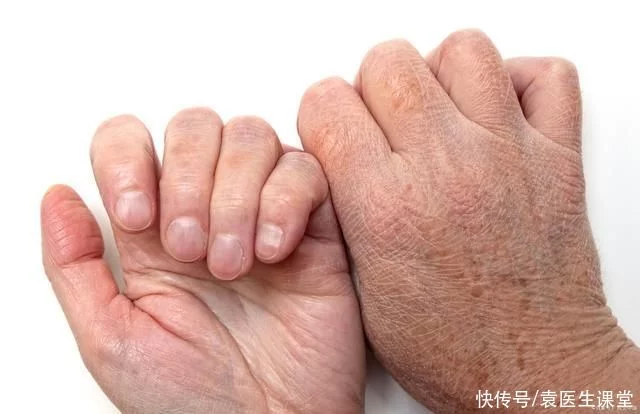 俗体打油·晨起后身体三种表现影响健康要重视