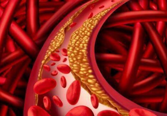 芹菜|芹菜是天然“降压菜”?别搞错了,真正能降压的其实是它!