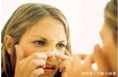 如果你没有这几个坏习惯,皮肤就不会留疤,中招的快改改吧!