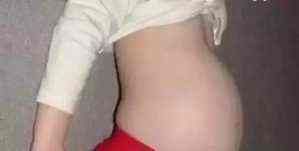 孕妇|4岁小女孩肚子大的好像孕妇一样,经检查后父母痛心不已