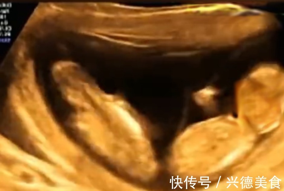 外面的世界|孕妈做四维彩超时突然腹痛,B超显示让人忍俊不禁,网友:挺无辜