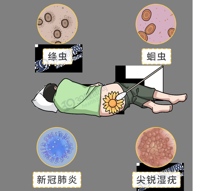 med|保护肛门有多重要？每天清洗肛门可以预防疾病？到底怎么回事？