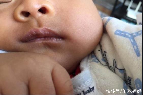 饮食|“脾胃虚”的宝宝，身上这2个部位经常出汗，父母早了解娃早受益