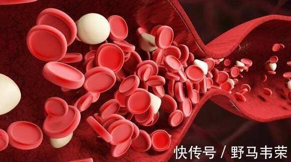 升高|三个信号出现在腿上，也许是因为血脂升高，尽量不要忽视！