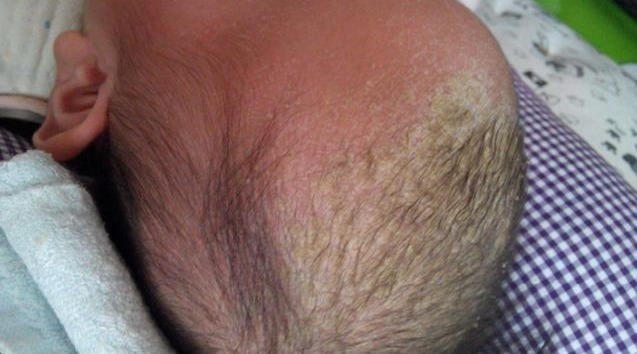 宝宝|宝宝突然身上掉皮,妈妈却不敢抱他,医院检查后,宝妈很尴尬了