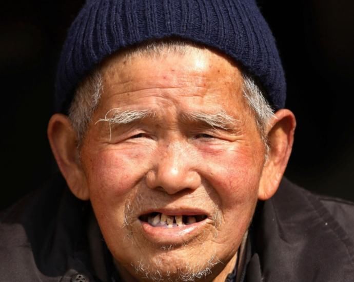 老年痴呆通常会有4大症状不注意,你将会是儿女的负担