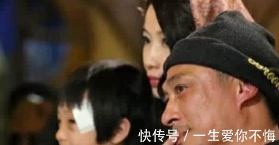 永久性|录《爸爸去哪儿》造成眼角永久性伤害，13岁费曼露无刘海正脸！
