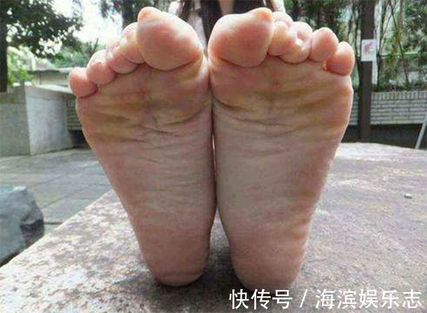 脚部|脚部出现“3迹象”,说明肝脏已“烂成渣”,为了健康要了解