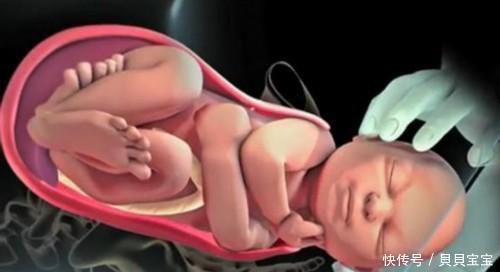 分娩|宫缩时产妇疼得“死去活来”,胎儿是啥感觉,看完憋住别笑