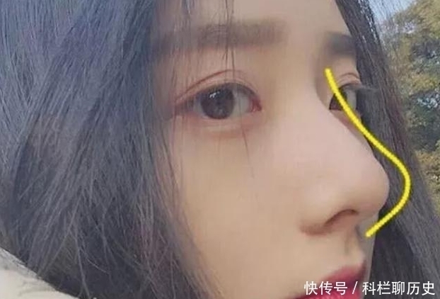 草莓鼻|女生“鼻子黑头”泛滥消不掉?教你3招,助你轻松摆脱“草莓鼻”