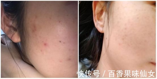 氨基酸洗面奶|你的洗面奶上“黑名单”了吗?这几款长痘烂脸的洗面奶,千万别选