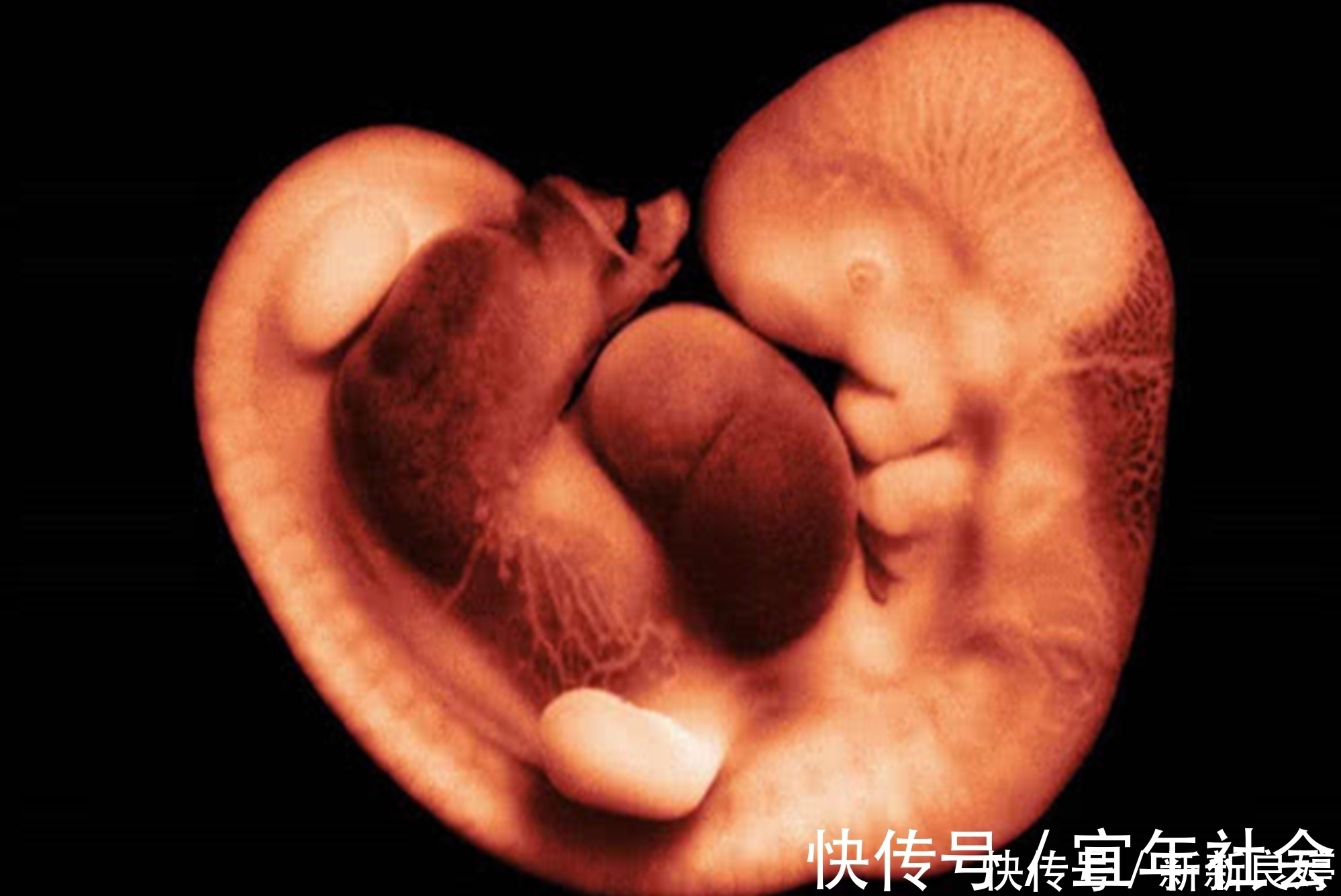 b超|孕期B超单上四个指标,暗示胎儿健康信号,达标孕妈可以放心了