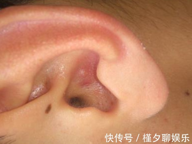 肤色|爸爸会遗传给孩子的4特点,男孩女孩都躲不了,挑老公不能大意