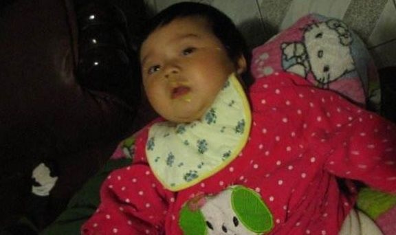 脾胃|儿科大夫:带娃发现身上有3个迹象,个头会越长越慢,家长要留心