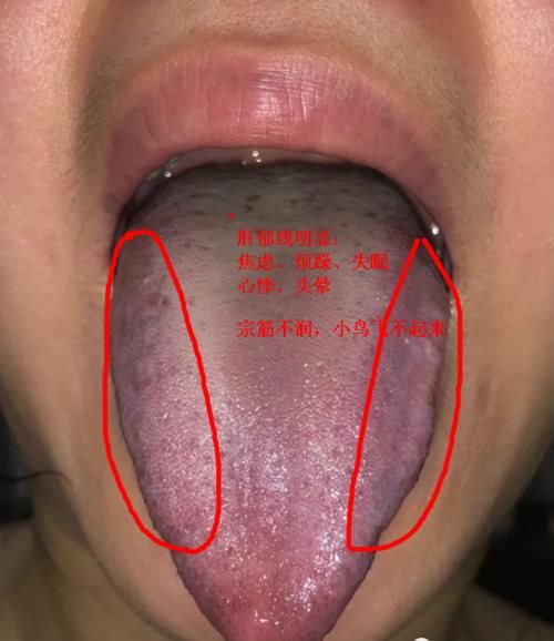六味地黄丸|想要补肾?分不清是肾阴虚,肾阳虚,还是肾精虚?教你一招区分