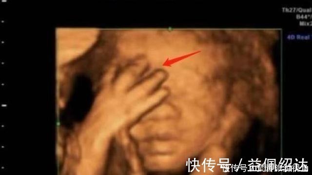 医生|“天才”胎儿走红,还在妈妈肚里就会“算数”,医生清华北大等你