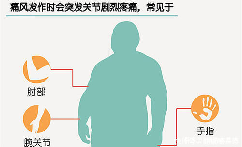 脚踝肿一按一个坑不疼