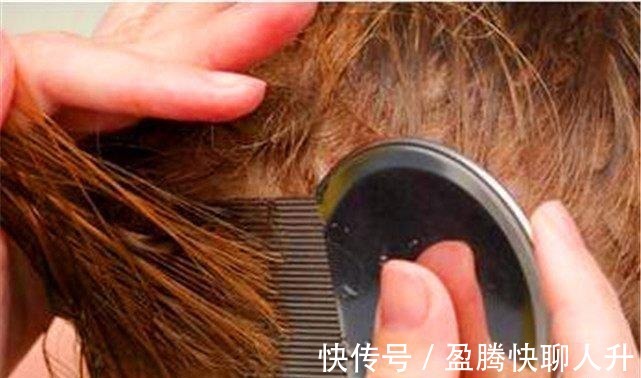 icu|女儿被妈妈用农药焗头驱虱进ICU，女人的无知比“农药”更可怕