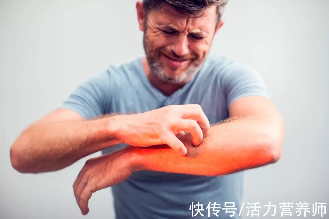 皮膚瘙癢|花生中的脂肪，是“萬惡之源”還是“養生佳品”？給三高人的建議