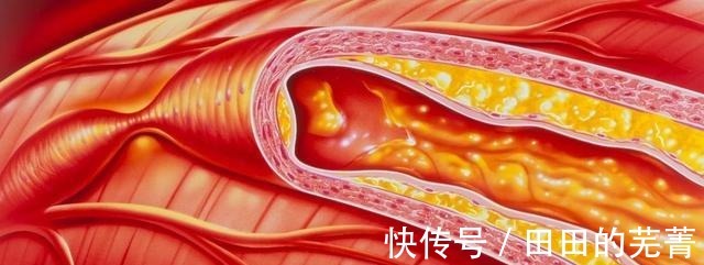 过敏|现在才知道，蚝油不能随便用，吃前谨记4不要，别再傻傻忽视了！