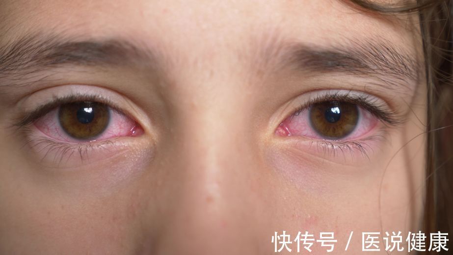 检查|1亿糖友面临失明的威胁?一旦确诊糖尿病,这个检查项目不能忽视