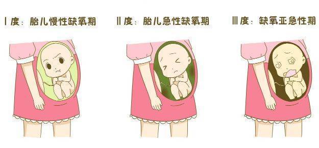 胎动|怀孕6个月，左侧卧睡时胎儿会在左腹部踢打，是不是他不舒服了？