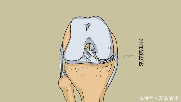 运动能不能降血压？高血压患者，天天坚持运动，会得到什么？