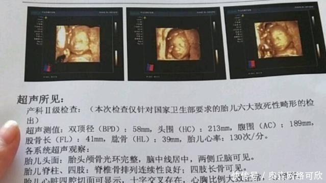 宝宝|准妈若怀有小阿哥，做B超时会有哪些数据？不妨验证一下吧