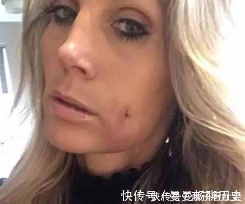 黑科技|整容界又现“黑科技”,酒窝也有人工的,网友:全身还有真的吗?