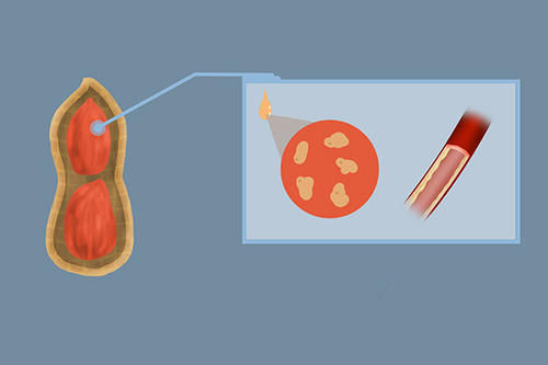 花生的营养被低估?每天吃多少花生,能起到养生效果?有答案了