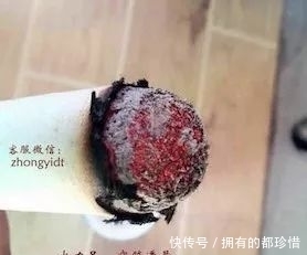 养生必谈足三里