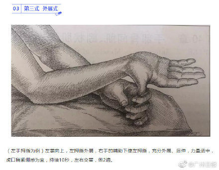 桡骨茎突狭窄性腱鞘炎|小伙狂打手游得了手机腕，动下拇指就疼！