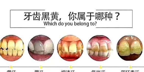  家庭美白仪|牙齿为何会变黄？牙黄应该怎么办？那些做法是误区你清楚吗？