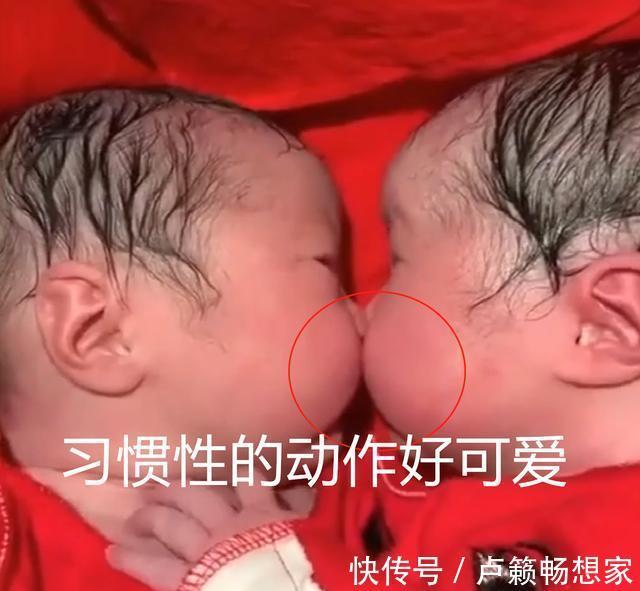 宝宝|刚出生的龙凤胎就一直亲,护士都分不开,画面实在太暖心了