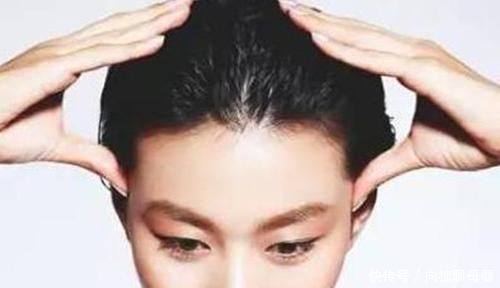 头皮屑|最近老是头油头屑多,你需要找到原因所在,3个方法快速去油去屑