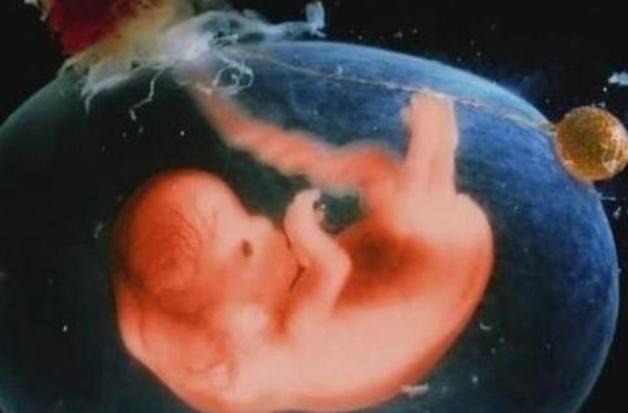 胎脂|孕期做到“4不碰”,有利于保持羊水“清澈”,胎儿住着更干净