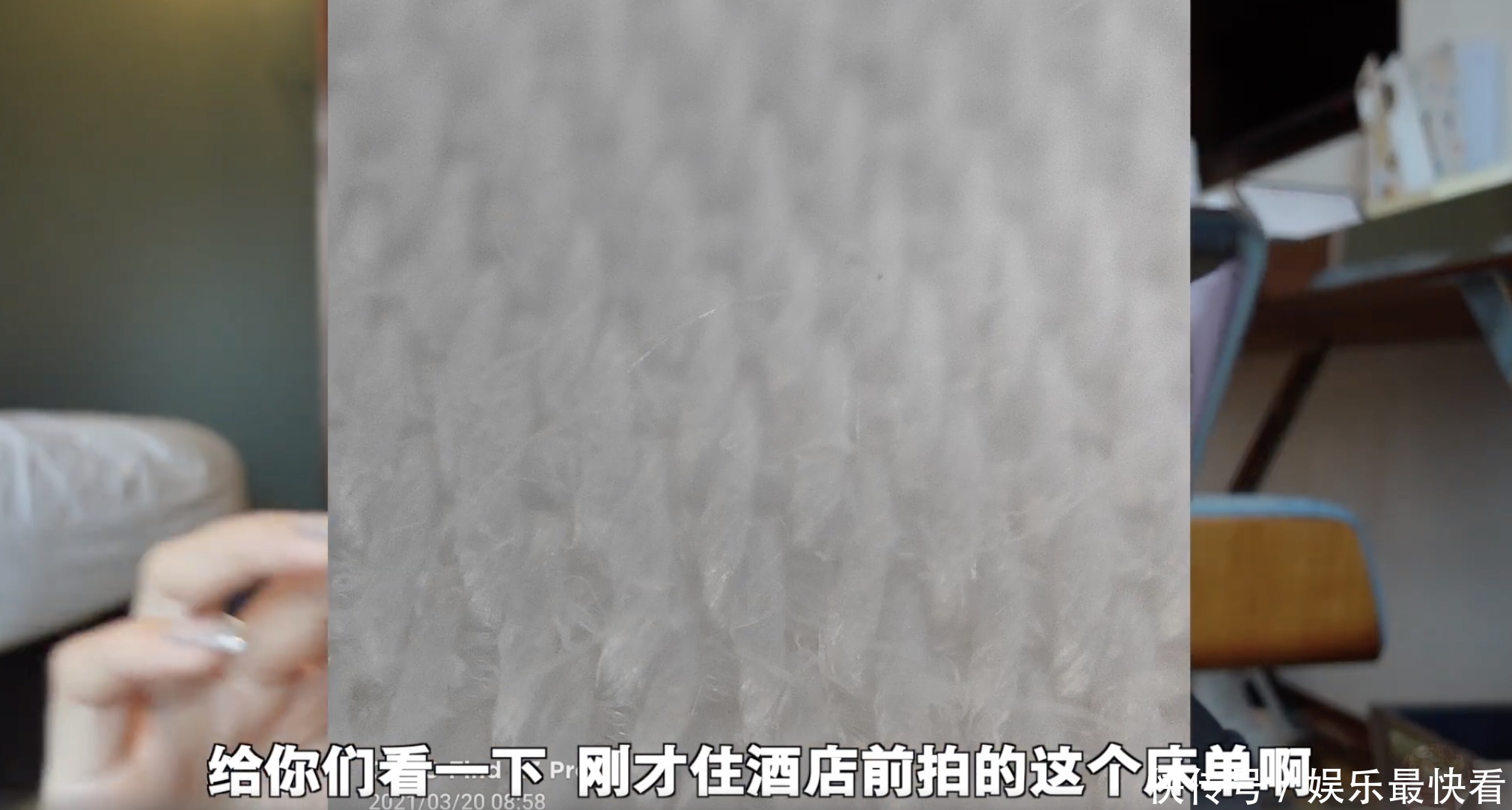 最近流行显微镜皮肤缺水测试?比美容院仪器还好使!直观又省钱