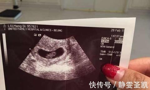 胚层|胎心胎芽出现的时间，为何有早有晚？这3个原因很说明问题