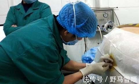 手术|第二次剖腹产真比第一次更疼?这里有标准答案,孕妈早知道早放心