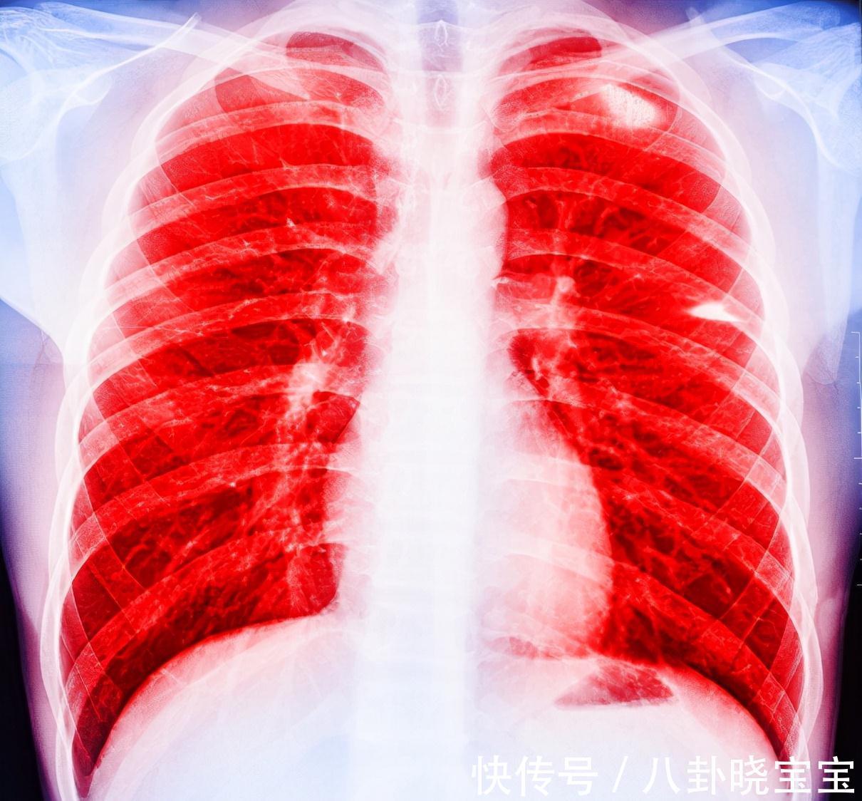 母亲|肺癌来临,睡觉先知!医生直言:肺部有癌的人,睡觉有这些表现