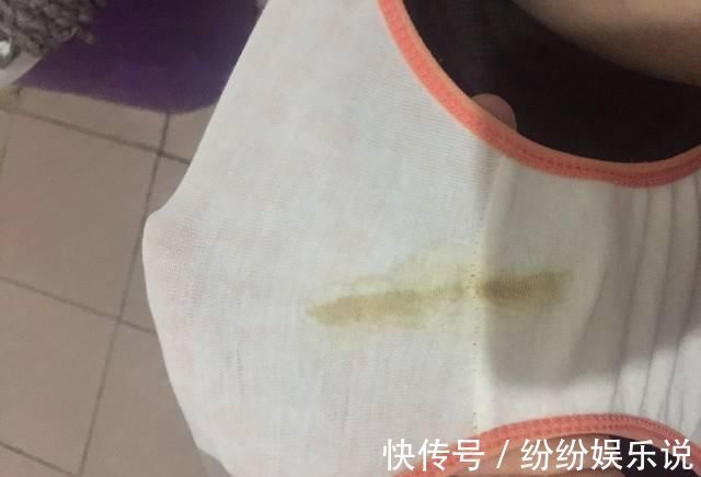 酒精肝|生殖系统发出的这3个信号,说明你的肝可能有问题了