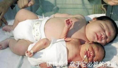 巨大儿|新生儿的“几斤几两”影响智商医生越接近这个数,孩子越聪明